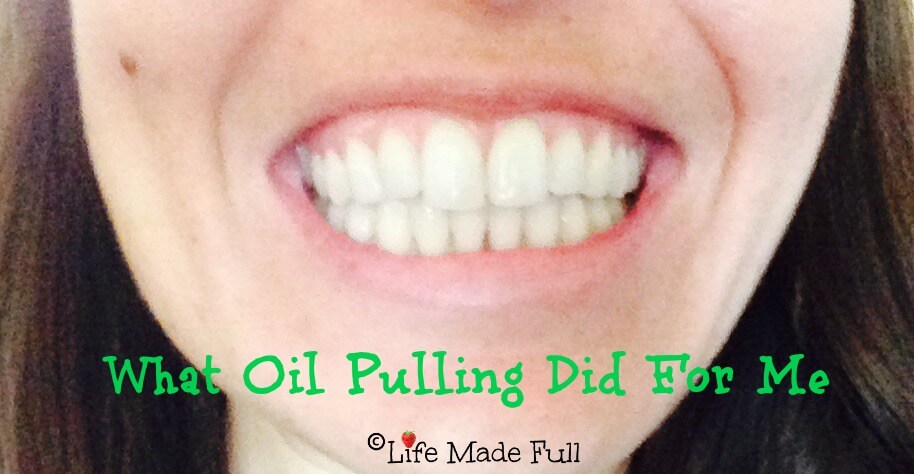 What Oil Pulling Did For Me